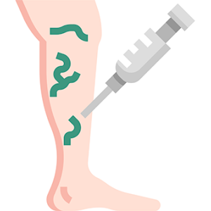 sclerotherapy