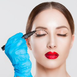 upper eyelid